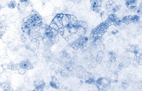 凍干機在生物組織保存中的應用